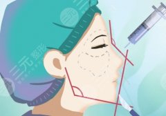 北京专门做鼻子的医院，从科室结构、医生专攻到案例集中度实战拆解