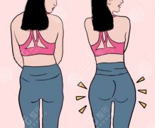 妈妈臀抽脂大概多少钱？抽脂+塑形的大致费用区间和不同预算能做到什么程度