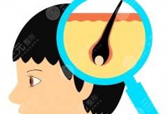 国内植发机构排名前十名，这十家国内植发机构为什么更受年轻人青睐？