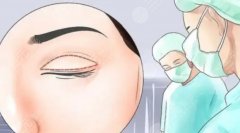 邢台做双眼皮好的医生，本地口碑不错的几位医生名单来了