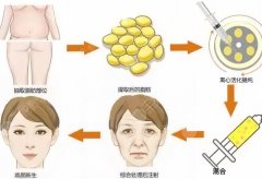 九院脂肪填充专家排名，擅长该项目的专家名单与特色风格大公开