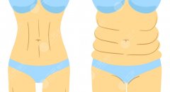 胃包吸脂有什么副作用？可能出现的副作用与风险，一篇讲清