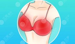 北京黄渭清医生隆胸怎么样？术前沟通要点、费用参考与术后护理提醒