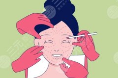 成都可做拉皮手术的医院，技术、费用、恢复期一文讲透