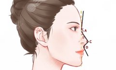 鼻部综合整形的价格表，一份实用的鼻部综合整形费用参考清单