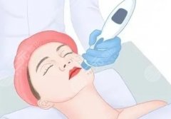 杭州超声炮认证医生，正规抗衰医生名单整理