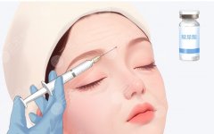 杭州玻尿酸填充哪个医生好？人气注射医生名单及擅长项目汇总