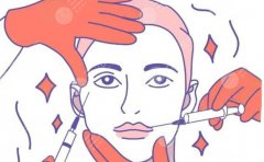 成都注射玻尿酸那家好？从资质、医生团队到售后服务的完整对比思路