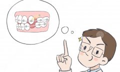 成都哪里可以做正颌手术，医院选择、团队构成与大致费用解析