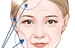 成都哪家做拉皮真实性价比高？几家做拉皮口碑不错、价格相对友好的医院推荐