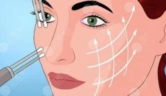 微拉美面部提升可以保持多久？效果衰减过程、补做频率以及如何延长维持期解析