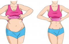 做双c腰的副作用，可能的并发症和术后不适一文讲清，帮你理性决策