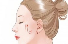 重庆哪家做拉皮手术好？不同医院手术方式、价格区间和特色优势对比