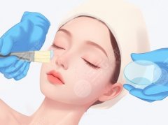 果酸换肤哪个牌子好？这几个院线+家用品牌值得蹲