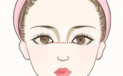 肋骨膨体隆鼻取出膨体后可以保留肋骨吗？过来人实测在线分享啦