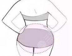 抽脂填臀部有用吗？普通人必看干货，这里讲透不踩坑