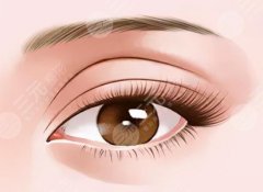 肿眼泡割双眼皮手术需要多少钱？费用明细揭晓，普通人看完再也不花冤枉钱