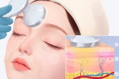 北京任冲川字纹切除多少钱？2026费用低至9k起！附医生简介