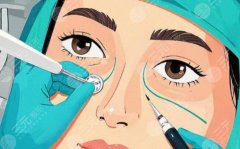南通第一人民医院割双眼皮多少钱？影响价格的关键变量都在这里