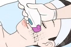 南京哪里做热玛吉比较好？怎么选机构不踩雷，面诊必问问题都整理了