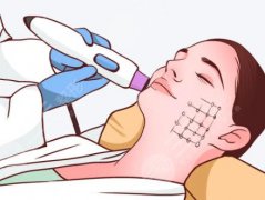 西安热玛吉价格多少钱是多少？2026收费细节公布！费用低至6k起