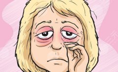 常州第二人民医院祛眼袋专家，选专家的关键标准，很多人第一条就做错