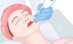 济南热玛吉价格多少钱？影响价格的关键因素一次讲明白