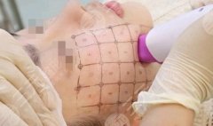 临沂热玛吉哪里好？当地口碑榜单揭晓，选对了才是真的值