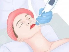 银川热玛吉五代做一次多少钱？全新价格表参考！费用低至6k起！