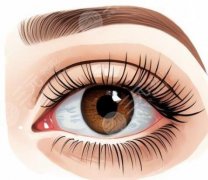 扬州哪家医院割眼袋好？5家靠谱医院实测，告别肿泡眼不踩雷