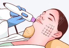 苏州热玛吉官方认证医院，正品设备+专业团队，这几家值得关注