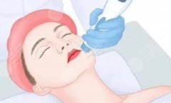 保定做热玛吉哪里好？本地人都在看的选择指南