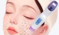 海口做一次热玛吉多少钱？一般在6k至3w元不等！价格明细等你来看