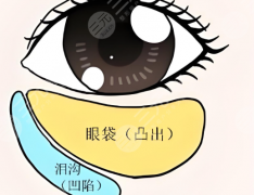 长治哪个医院做眼袋好？口碑好的医院有五家