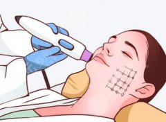 湛江热玛吉价格多少钱？价格表公布！附推荐医院名单