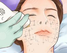 三亚哪家医院热玛吉好？5家正规好院详细解析