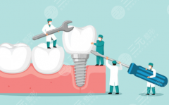 泉州慧光口腔种植牙怎么样？多少钱？技术、口碑、收费一次看明白