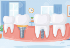 佛山粤丽口腔种植牙怎么样？多少钱？医生技术、项目特色、价格区间全面盘点