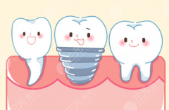 威海中诺口腔种植牙怎么样？多少钱？价格透明吗，看完这篇心里有数