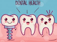 南昌博德口腔种植牙怎么样？多少钱？不同种植体品牌的报价差距整理好了