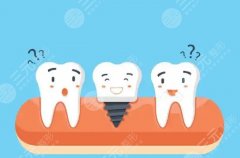 重庆大坪泰康拜博口腔种植牙怎么样?多少钱?收费处于什么水平? 重庆大坪泰康拜博口腔种植牙怎么样?多少钱?收费处于什么水平?