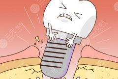 上海美信口腔种植牙怎么样？多少钱？项目反馈和价格参考，这篇给你盘明白