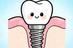 包头牙博士口腔种植牙怎么样？多少钱？真实评价和收费情况，这篇整理全了