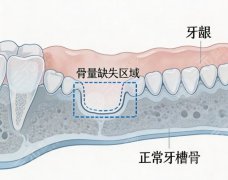 泰州市柏悦口腔种植牙怎么样？多少钱？种植牙口碑到底如何，价格这次也讲透