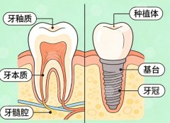 义乌牙科医院种植牙怎么样？多少钱？医院种牙反馈汇总，常见花费顺手整理