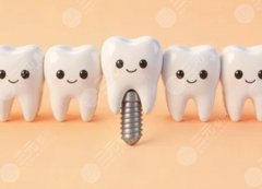 厦门美可普口腔种植牙怎么样？多少钱？种植牙评价和价格参考，看完更好做决定