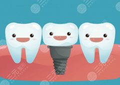 湛江万之达口腔种植牙怎么样？多少钱？种牙口碑和收费参考一次了解