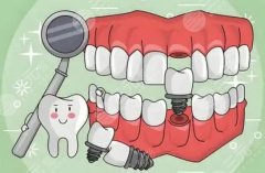 南京晶齿丽口腔种植牙怎么样？多少钱？项目特色和价格区间一起看看