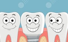 济南众牙口腔种植牙怎么样？多少钱？项目评价和收费标准一并盘点