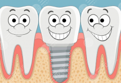 楚雄柠檬口腔种植牙怎么样？多少钱？口碑如何、价格贵不贵速览